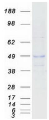 Coomassie blue staining of purified TNFRSF14 protein.